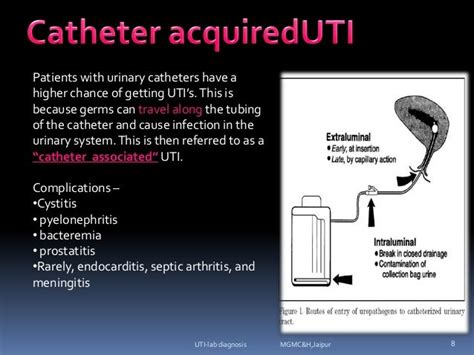 urinary tract infections-Lab diagnosis (e.coli, klebsilla, proteus, p…