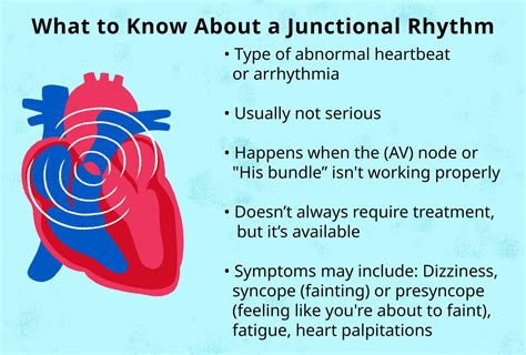 What Is a Junctional Rhythm?