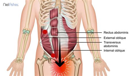 External Oblique Muscle