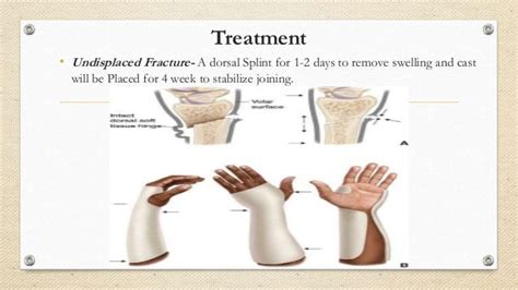 Colles fracture presentation