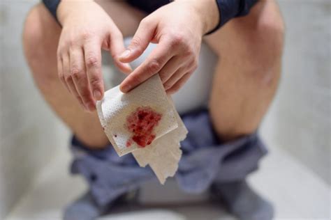 What Can Blood on Toilet Paper but Not on Stool Mean? » Scary Symptoms