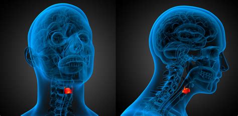 A Successful Series of Procedures for Patient with Laryngeal Cancer ...