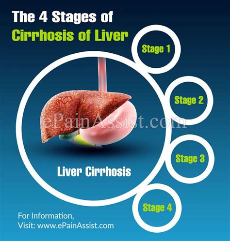 Pin on Abdominal Pain or Stomach Pain