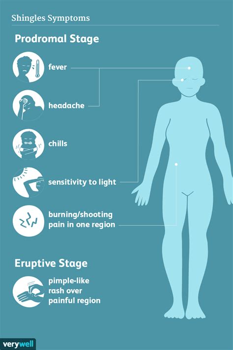 What Does Shingles Feel Like?