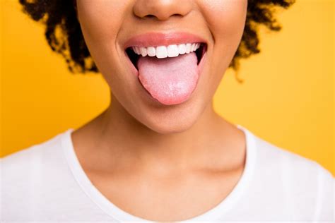 Geographic Tongue Causes, Symptoms, & Treatment | CariFree