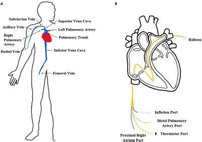 Frontiers | An Inexpensive Cardiovascular Flow Simulator for Cardiac ...