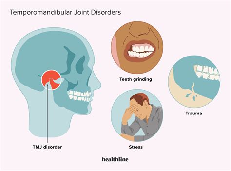 TMJ (Temporomandibular Joint) Disorders: Symptoms and More