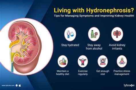 Hydronephrosis: Causes, Diagnosis, Treatment and Prevention - By Dr ...