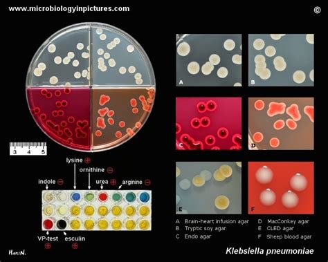 Enterobacter Aerogenes Morphology