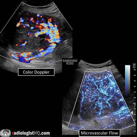 Radiologist Headquarters on Instagram: “Key teaching points from Case ...