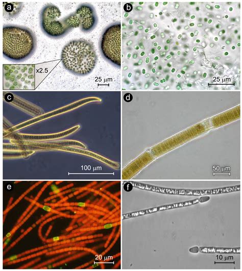 Life | Free Full-Text | Mitigating Harmful Cyanobacterial Blooms in a ...