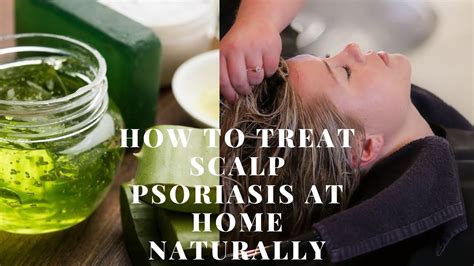 12 Best Home Remedies To Improve Scalp Psoriasis Effectively Scalp ...