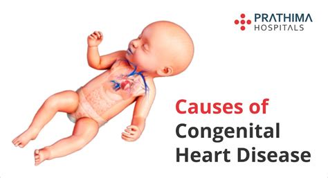 Know About Congenital Heart Disease | Prathima hospitals