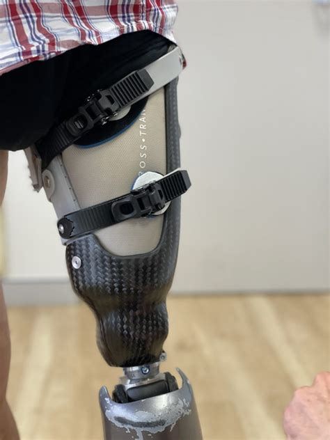 Prosthetic Knee - Microprocessor Controlled Knees | APC Prosthetics