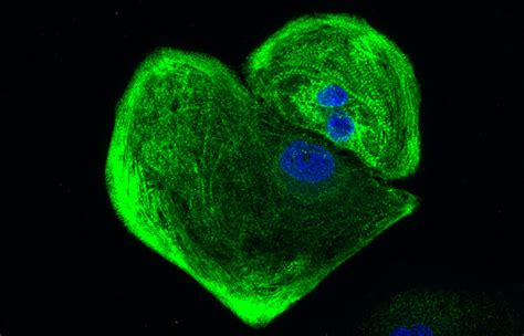 Genetic heart disease | Centenary Institute