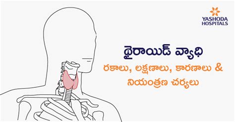 థైరాయిడ్(Thyroid) వ్యాధి: రకాలు, లక్షణాలు & నియంత్రణ చర్యలు