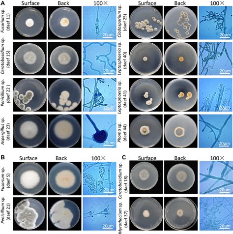 Morphological characteristics of endophyte fungi. Photographs showing ...