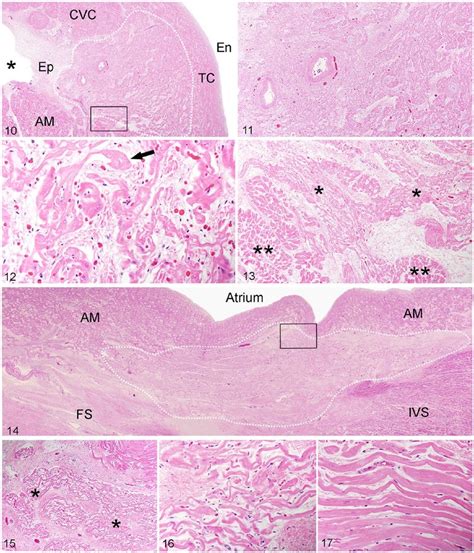 Histology of the sinoatrial node (SAN). H&E. Figure 10. Outline of the ...