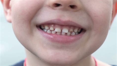 A Young Boy's Joyful Smile On White Stock Footage SBV-335777232 ...