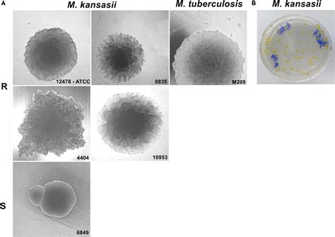 Frontiers | A Murine Model of Mycobacterium kansasii Infection ...