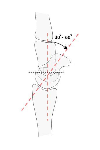 Wrist Measurements | Lace up flat, Wrist, Lace up