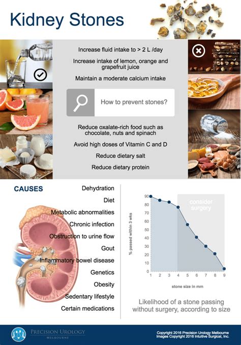 Precision Urology Melbourne | Kidney Stones