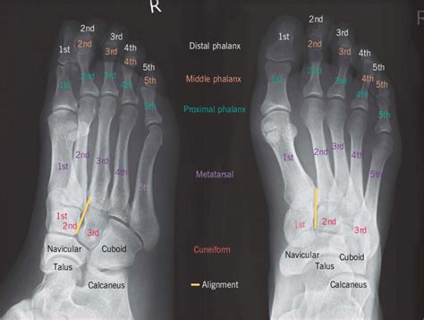 Foot Xray Anatomy