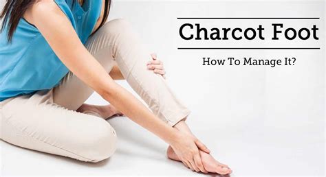 Charcot Foot: Symptoms, Causes, and Treatments | Diabetes Care