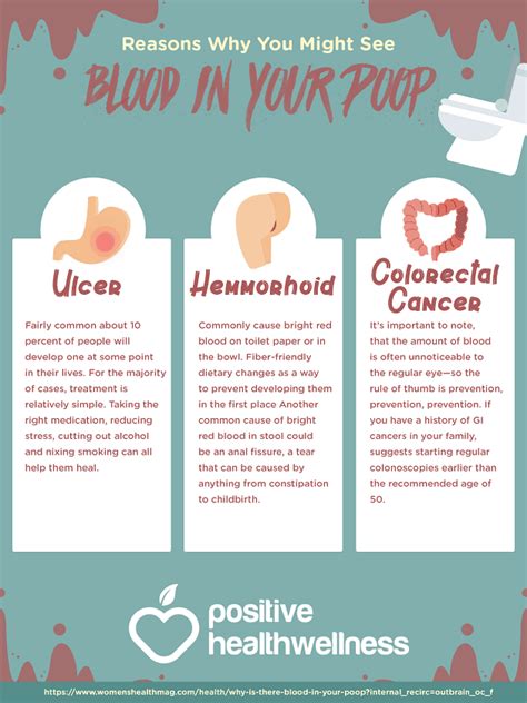 4 Reasons Why You Might See Blood In Your Poop – Infographic – Positive ...