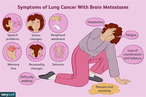 Lung Cancer Spread to Brain: Symptoms and Life Expectancy