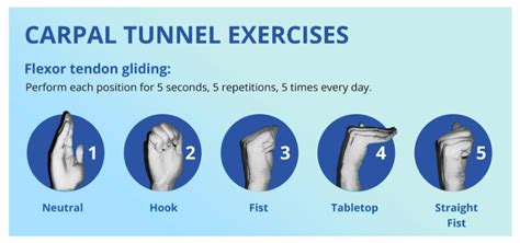 Exercises for Carpal Tunnel Pain | CORE Orthopedics