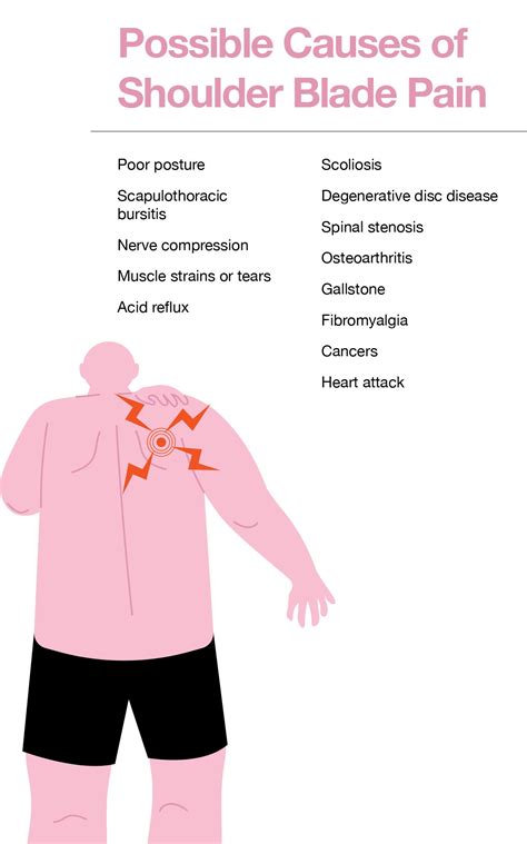 Shoulder Blade Pain Causes Treatment And Prevention | Porn Sex Picture