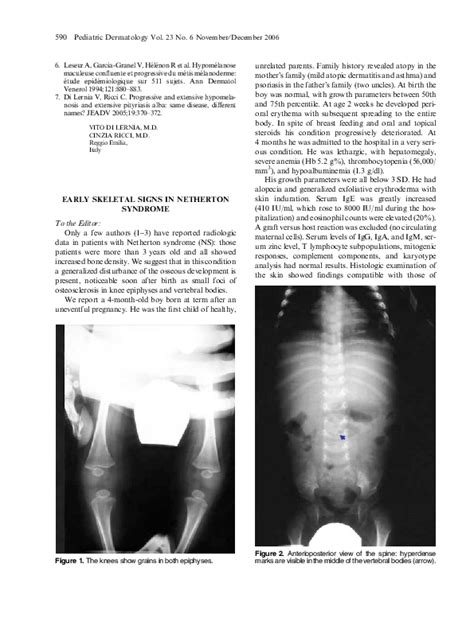 (PDF) Early Skeletal Signs in Netherton Syndrome | Cinzia Magnani and ...