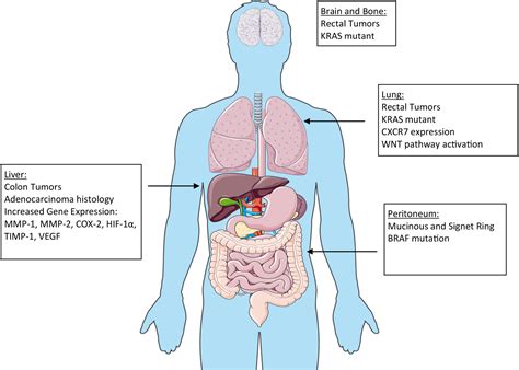 Surgical Treatment of Metastatic Colorectal Cancer - Surgical Oncology ...