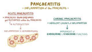 Causes Of Pancreatitis Mnemonic