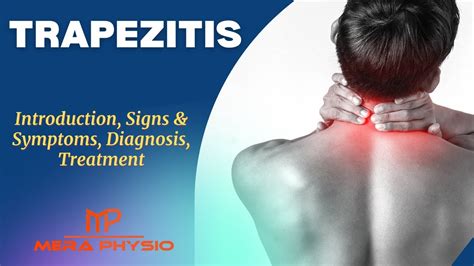 Trapezitis | Introduction, Signs & Symptoms, Diagnosis, Treatment | In ...