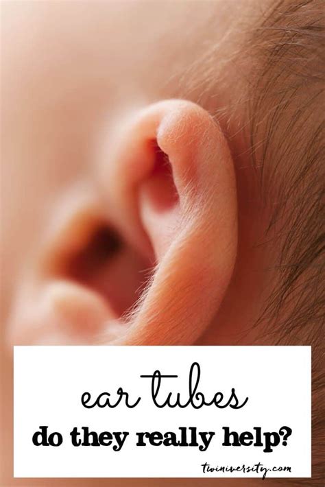 What to Expect with Ear Tubes Surgery for Kids - Twiniversity