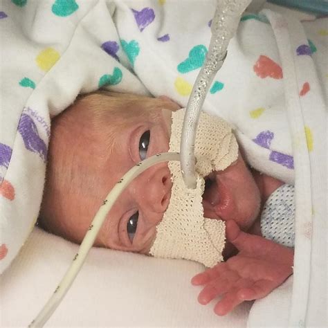 Micro Preemie Milestones: Hailey's Story - Shann Eva's Blog