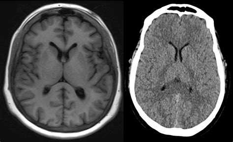 Mediphany | How to read an MRI or CT scan