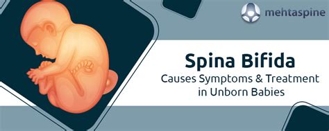 Spina Bifida Causes Symptoms & Treatment in Unborn Babies