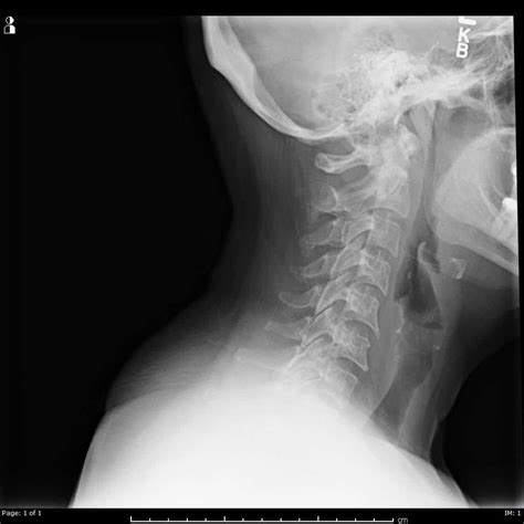 X-Ray Neck - Oregon Advanced Imaging