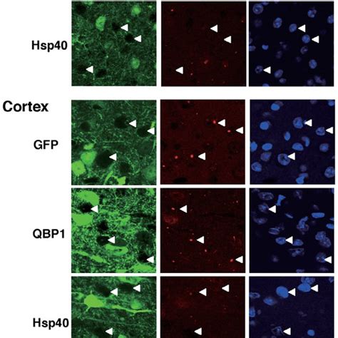 Htt inclusion body formation in 8 week old R6/2 mouse brains injected ...