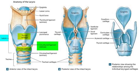 Laryngitis Diagram