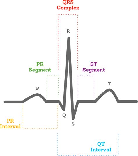 ecg diagram