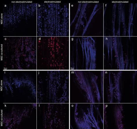 Neurofilament heavy chain (NF-hc) staining of neuroblastoma cells ...