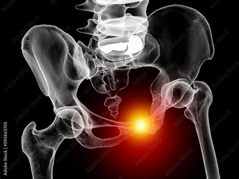 Symphysis pubis dysfunction, 3D illustration Stock Illustration | Adobe ...