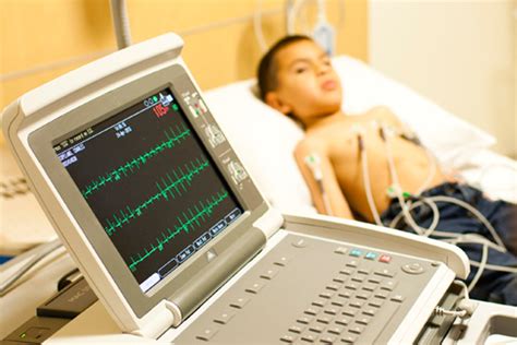 Electrocardiograms (ECG) - CHOC Children's