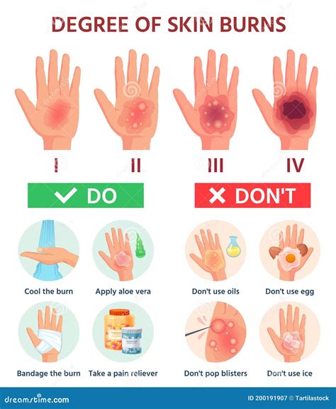 Skin Burn Severity Chart