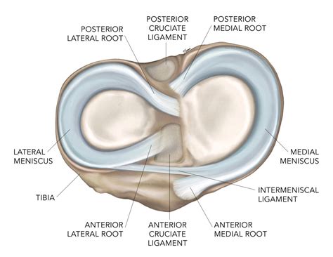 Meniscal Root Tears - Dr. Chris Jones Colorado Springs, CO