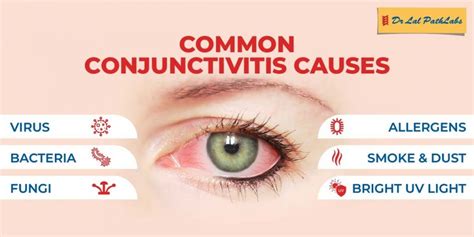 Conjunctivitis: Causes, Symptoms, and Types | Dr. Lal PathLabs